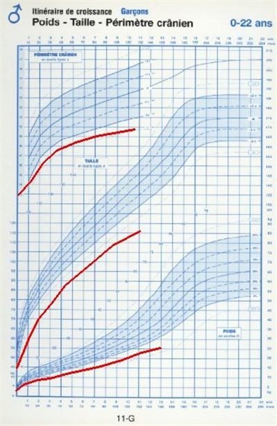 découvrez la déviation standard, une mesure statistique essentielle qui permet d'évaluer la dispersion des données par rapport à leur moyenne. apprenez comment l'utiliser pour interpréter vos résultats et prendre des décisions éclairées dans vos analyses.